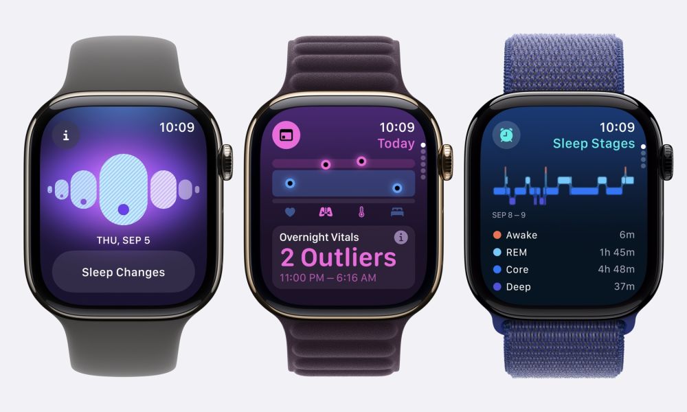 Glowtime Apple Watch Series 10 38