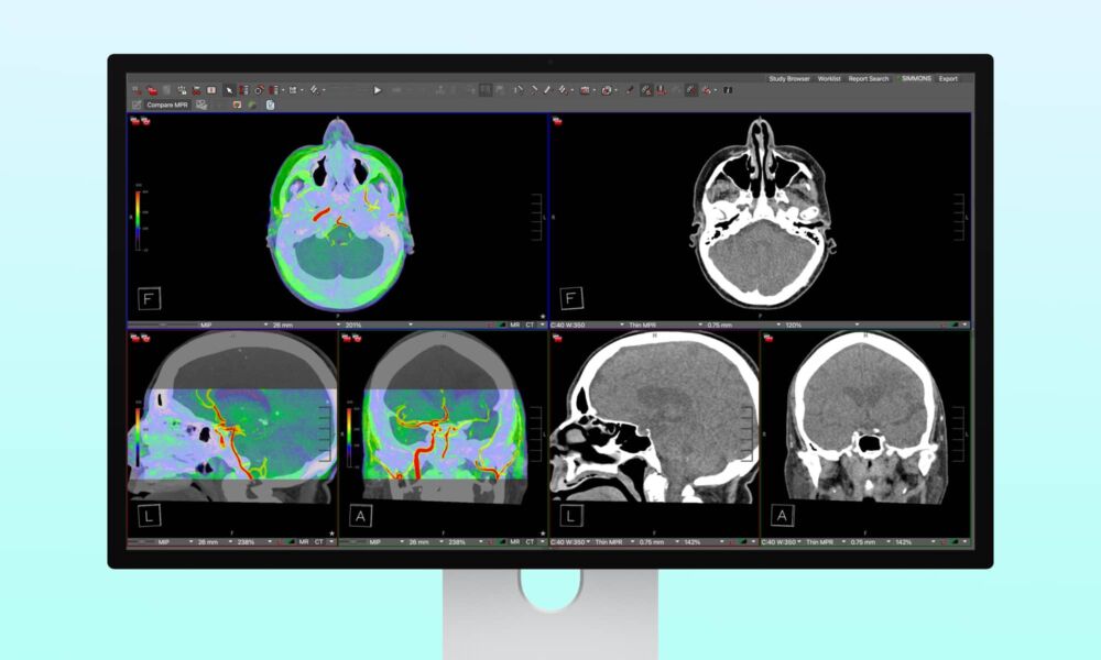 Apple Studio Display XDR DICOM Medical Imaging Hero