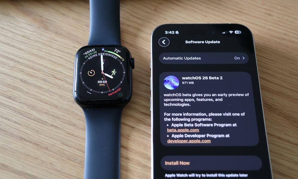 Apple Watch update